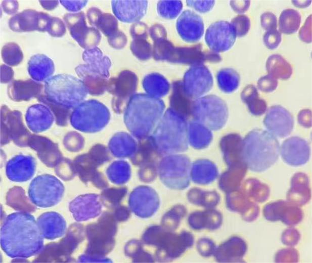 （2014）犬猫白血病检测组合