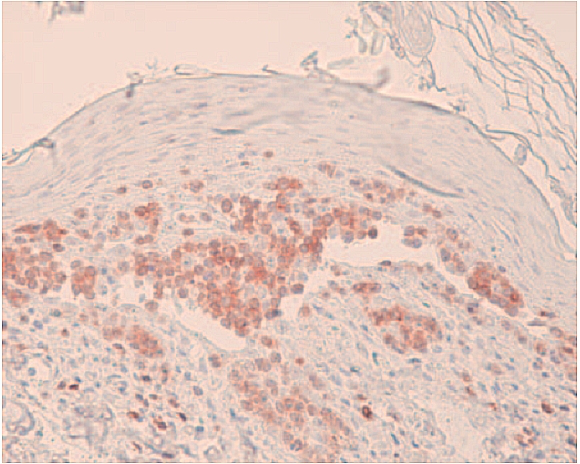 （2009）利用免疫组织学检测优化肿瘤诊断